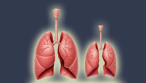 New Study Calls for Early Action as Lungs Begin to Decline Sooner Than Earlier Thought